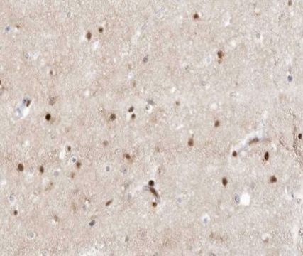 ZIC1/ZIC2/ZIC3 Antibody in Immunohistochemistry (Paraffin) (IHC (P))