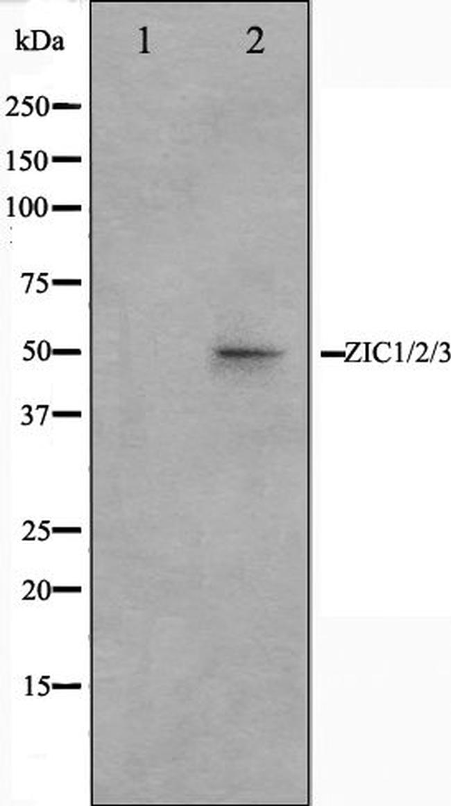 ZIC1/ZIC2/ZIC3 Antibody in Western Blot (WB)