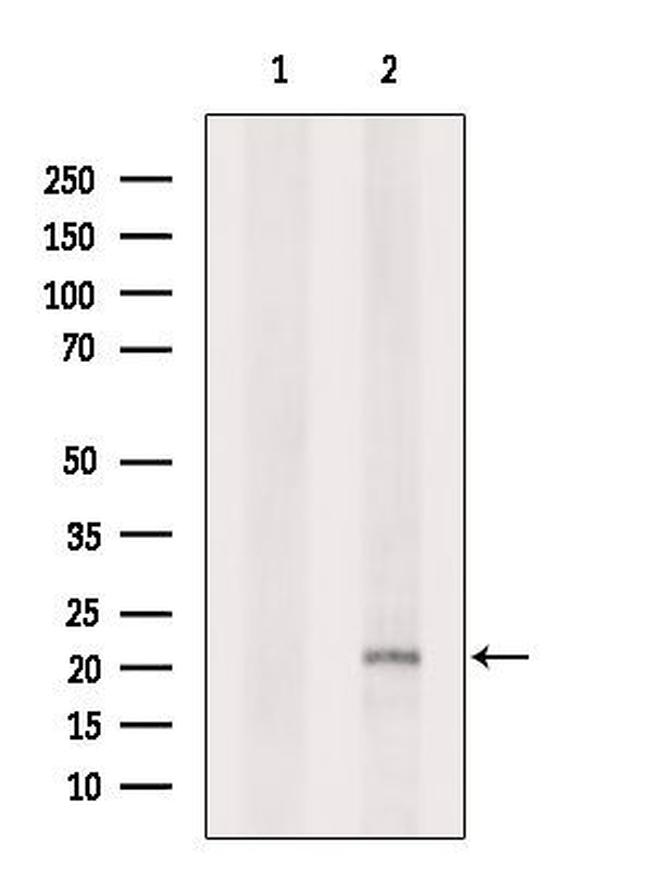 C1orf57 Antibody in Western Blot (WB)
