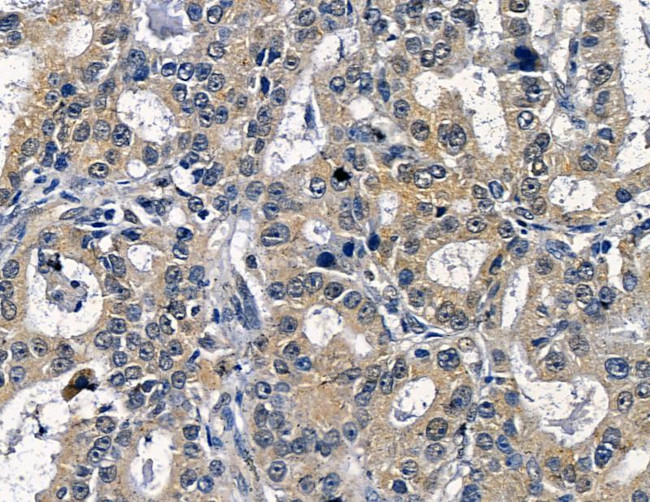 SLC4A1AP Antibody in Immunohistochemistry (Paraffin) (IHC (P))