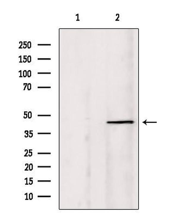 PIAS1 Antibody in Western Blot (WB)