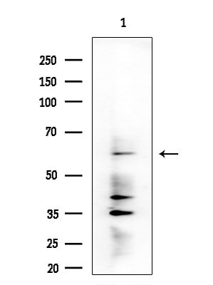 DMPK Antibody in Western Blot (WB)