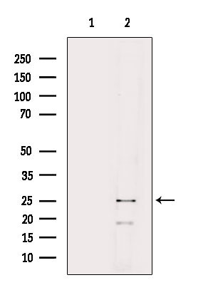 NRIP2 Antibody in Western Blot (WB)
