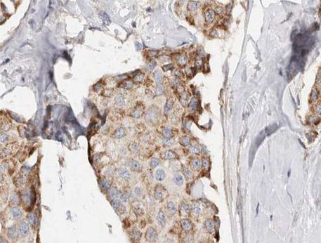 PHLDA2 Antibody in Immunohistochemistry (Paraffin) (IHC (P))