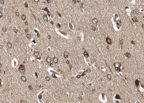 Phospho-NMDAR1 (Ser897) Antibody in Immunohistochemistry (Paraffin) (IHC (P))