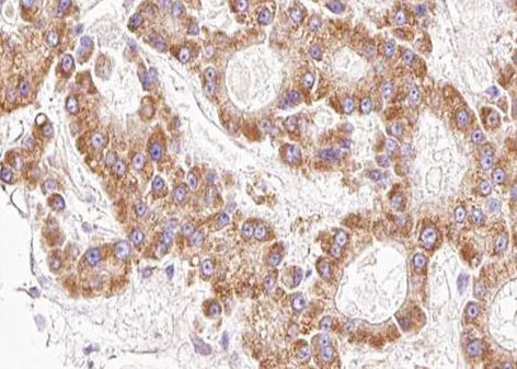 Phospho-AKT1/AKT2/AKT3 (Ser473) Antibody in Immunohistochemistry (Paraffin) (IHC (P))