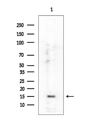 H3K23ac Antibody in Western Blot (WB)