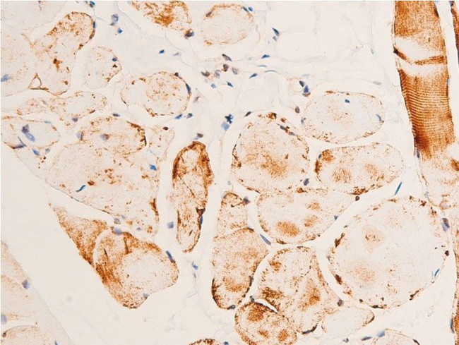 Phospho-Chk1 (Ser280) Antibody in Immunohistochemistry (Paraffin) (IHC (P))