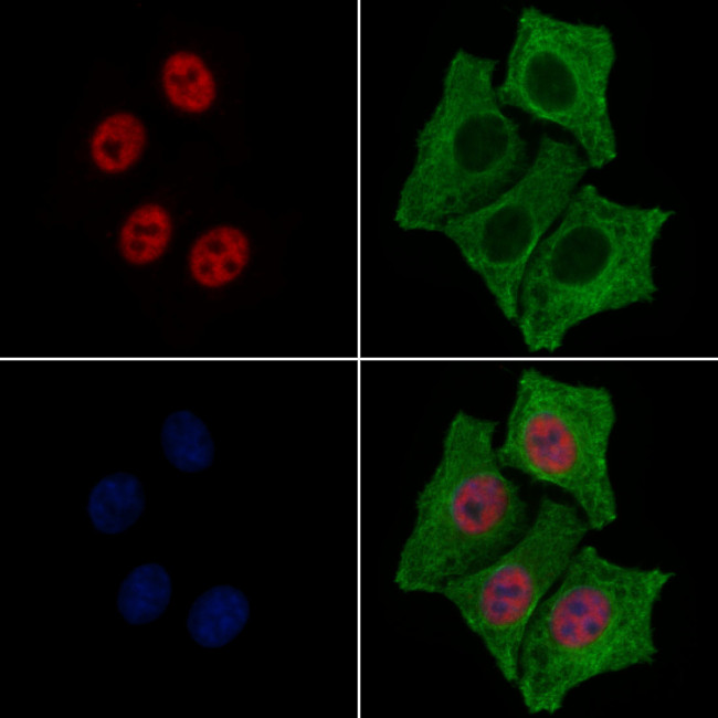 Phospho-Estrogen Receptor alpha (Ser118) Antibody in Immunocytochemistry (ICC/IF)