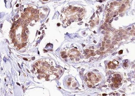 Phospho-Estrogen Receptor alpha (Ser118) Antibody in Immunohistochemistry (Paraffin) (IHC (P))