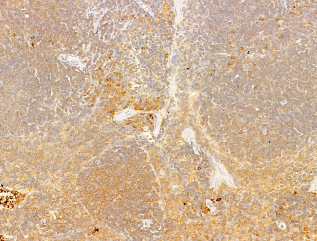 Phospho-LCK (Tyr505) Antibody in Immunohistochemistry (Paraffin) (IHC (P))