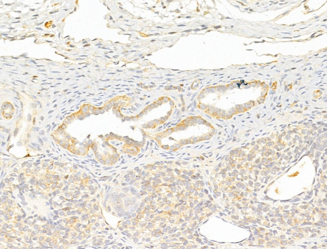 Phospho-LCK (Tyr505) Antibody in Immunohistochemistry (Paraffin) (IHC (P))