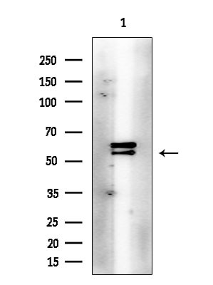 Phospho-LCK (Tyr505) Antibody in Western Blot (WB)