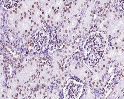 Phospho-LCK (Tyr505) Antibody in Immunohistochemistry (Paraffin) (IHC (P))