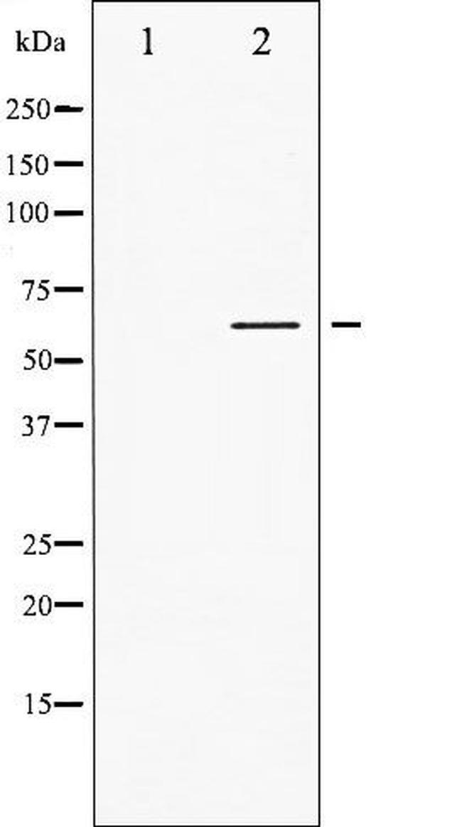 Phospho-LCK (Tyr505) Antibody in Western Blot (WB)