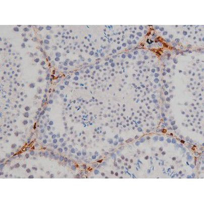 Phospho-Lyn (Tyr508) Antibody in Immunohistochemistry (Paraffin) (IHC (P))