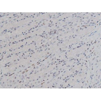 Phospho-Lyn (Tyr508) Antibody in Immunohistochemistry (Paraffin) (IHC (P))