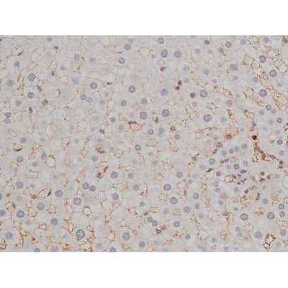 Phospho-Lyn (Tyr508) Antibody in Immunohistochemistry (Paraffin) (IHC (P))