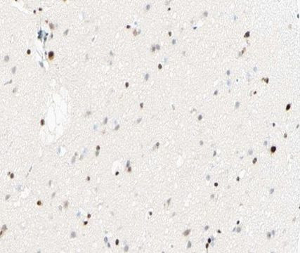 Phospho-NFkB p105 (Ser893) Antibody in Immunohistochemistry (Paraffin) (IHC (P))