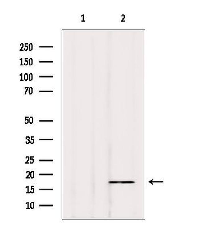 Phospho-Alpha-synuclein (Tyr136) Antibody in Western Blot (WB)