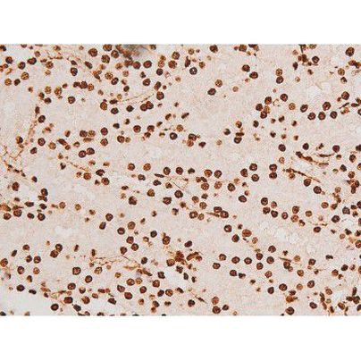 Phospho-C-rel (Ser503) Antibody in Immunohistochemistry (Paraffin) (IHC (P))