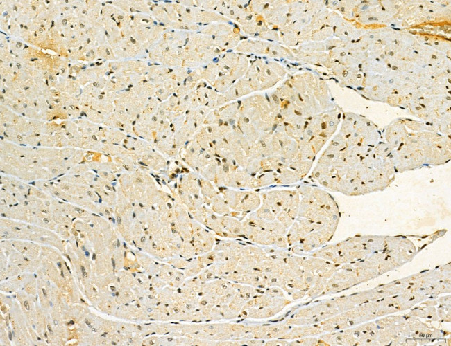 MKL1 Antibody in Immunohistochemistry (Paraffin) (IHC (P))