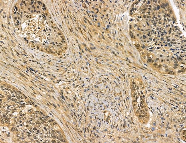 MKL1 Antibody in Immunohistochemistry (Paraffin) (IHC (P))