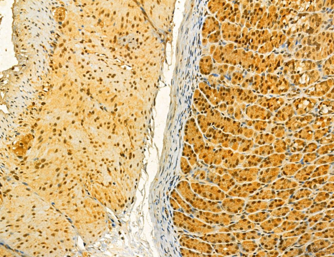 MKL1 Antibody in Immunohistochemistry (Paraffin) (IHC (P))