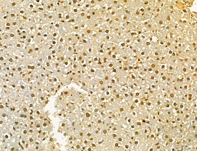 MKL1 Antibody in Immunohistochemistry (Paraffin) (IHC (P))