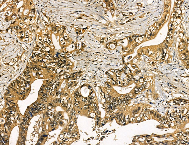 MKL1 Antibody in Immunohistochemistry (Paraffin) (IHC (P))