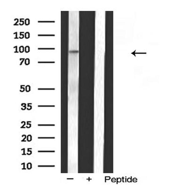 MKL1 Antibody in Western Blot (WB)