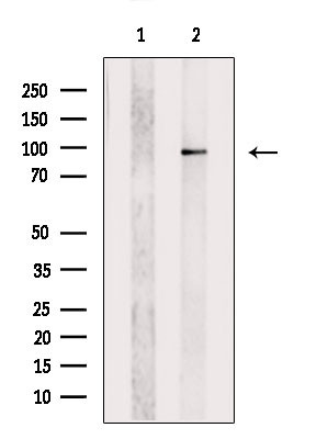 MKL1 Antibody in Western Blot (WB)