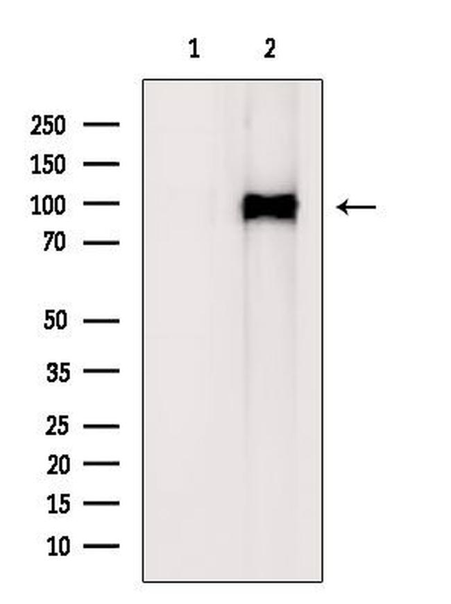 NOTCH1 (Cleaved Val1744) Antibody in Western Blot (WB)