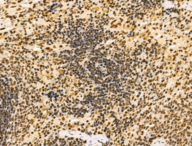 PIASy Antibody in Immunohistochemistry (Paraffin) (IHC (P))