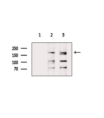 Fibronectin Antibody in Western Blot (WB)