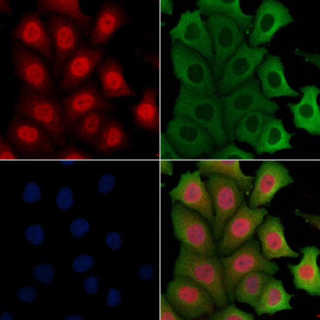 Fra2 Antibody in Immunocytochemistry (ICC/IF)