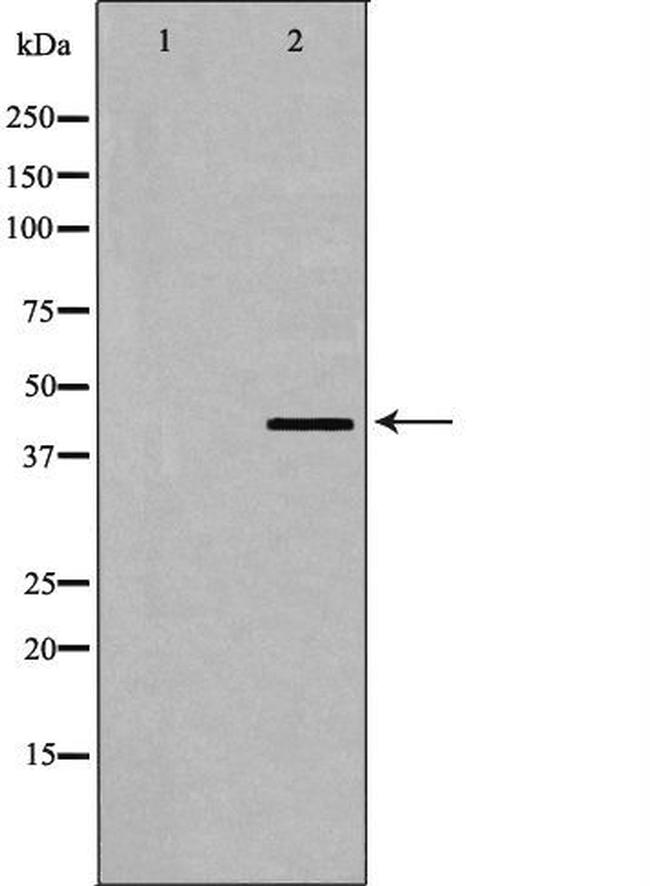 Dematin Antibody in Western Blot (WB)