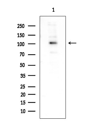 RB1 Antibody in Western Blot (WB)