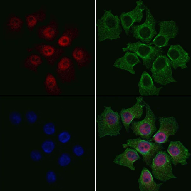 RB1 Antibody in Immunocytochemistry (ICC/IF)