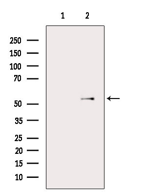 PI3K p85/p55 Antibody in Western Blot (WB)