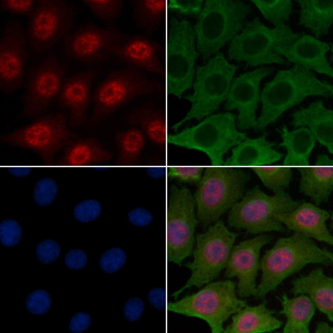 RPS6KB2 Antibody in Immunocytochemistry (ICC/IF)