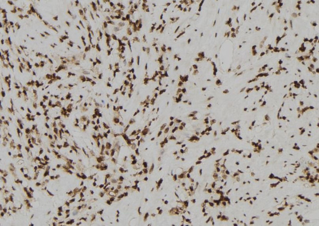 Acrosin Antibody in Immunohistochemistry (Paraffin) (IHC (P))