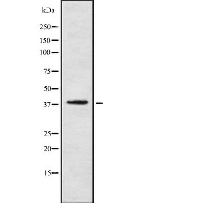 PNCK Antibody in Western Blot (WB)