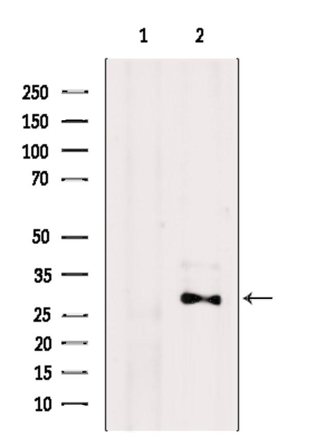 GRAP Antibody in Western Blot (WB)