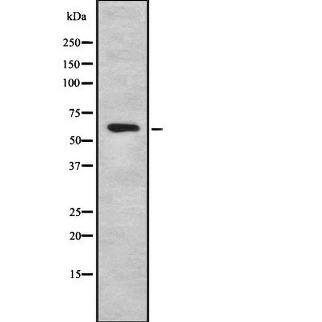 HABP2 Antibody in Western Blot (WB)