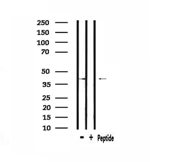 HORMAD1 Antibody in Western Blot (WB)