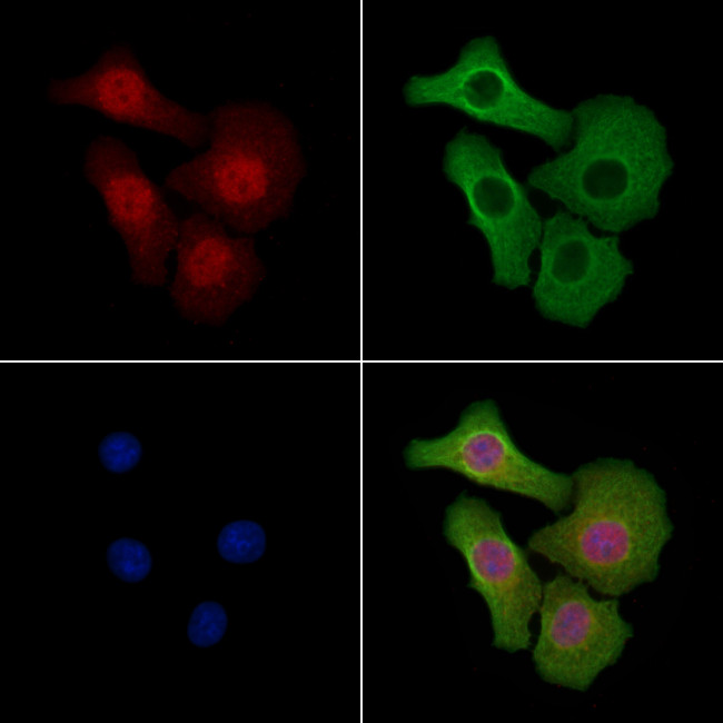 HOXD10 Antibody in Immunocytochemistry (ICC/IF)