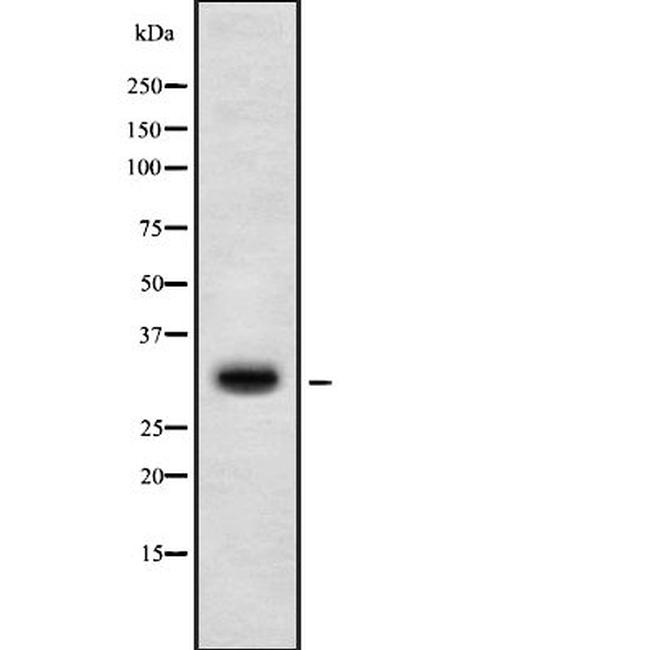 HOXD10 Antibody in Western Blot (WB)