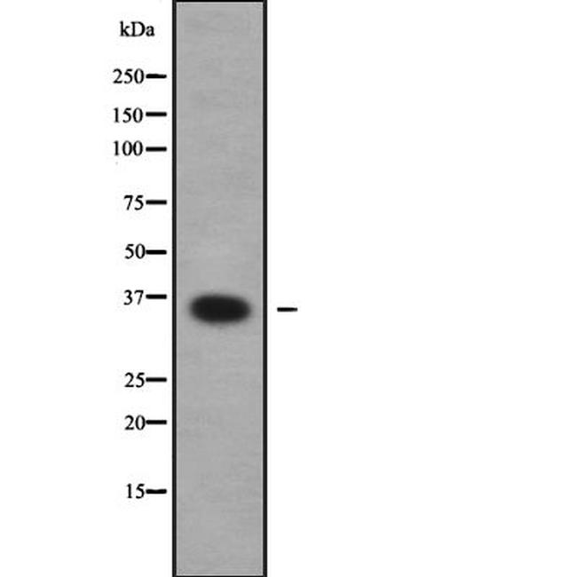 NANOGP8 Antibody in Western Blot (WB)