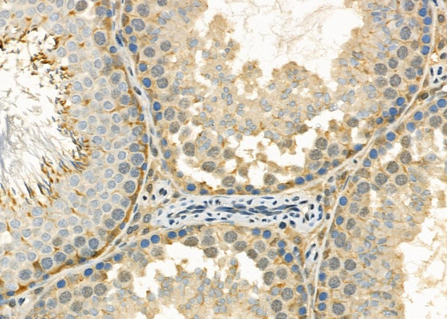 OTUB2 Antibody in Immunohistochemistry (Paraffin) (IHC (P))